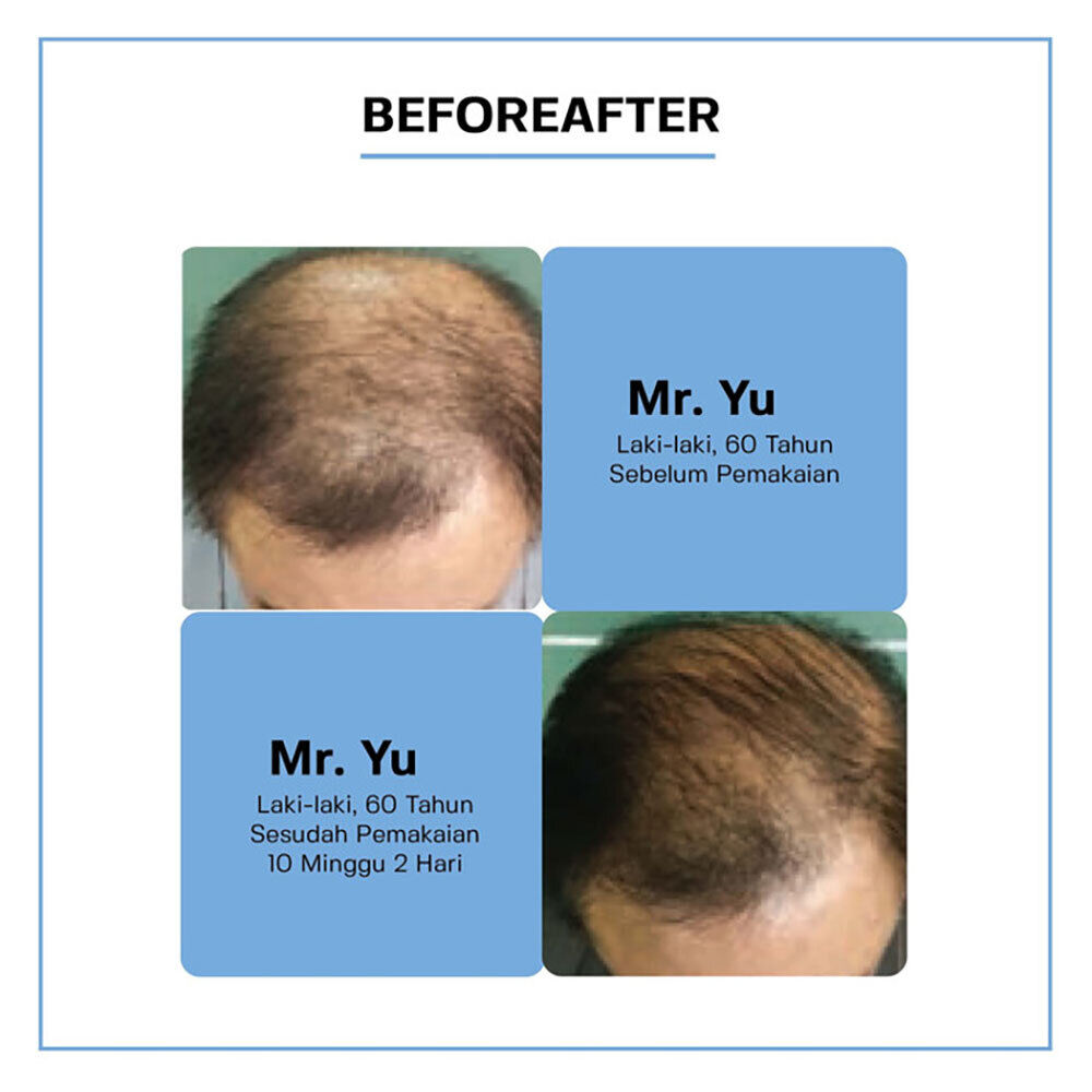 DAENG GI MEO RI VITALIZING SCALP NUTRITION PACK FOR HAIR-LOSS CARE 145ML