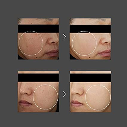 DONGSUNG RANNCE CREAM 2.46 OZ