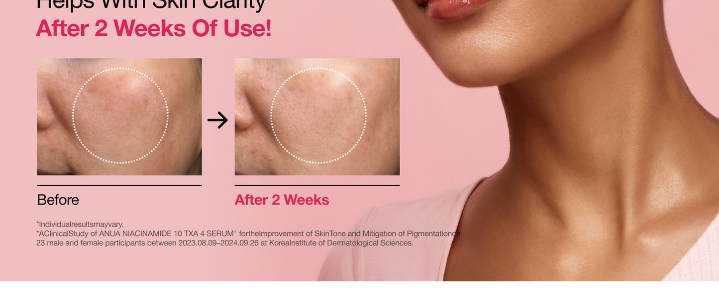 ANUA NIACINAMIDE10% + TXA 4% SERUM 30mL