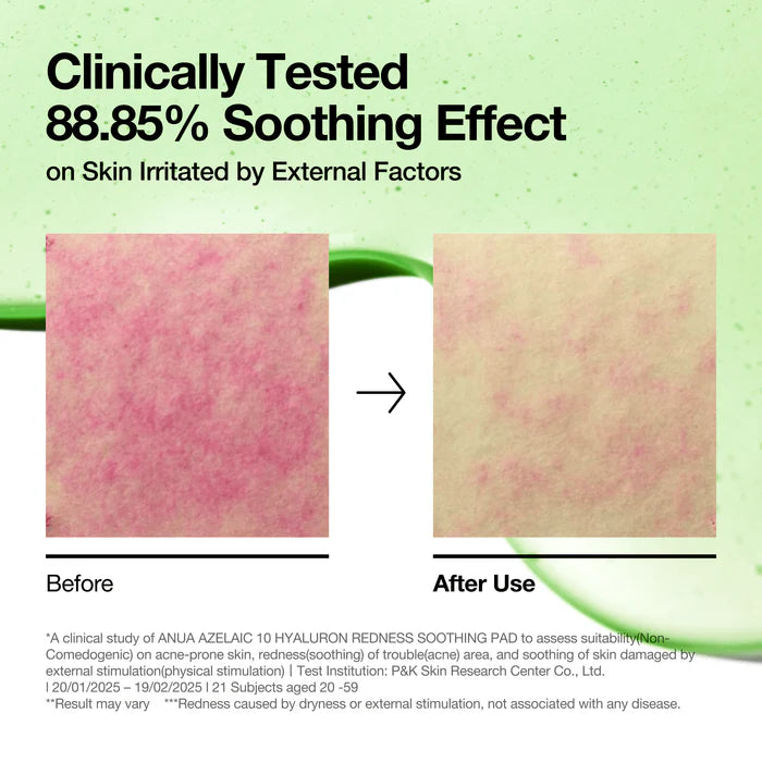 ANUA Azelaic Acid 10 Hyaluron Redness Soothing Pad - 90 Pads